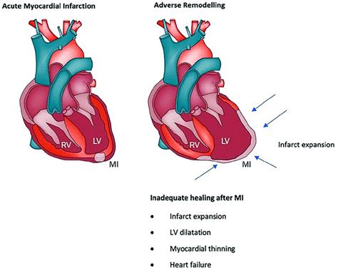 lv cardiac|lvhn cardiology locations.